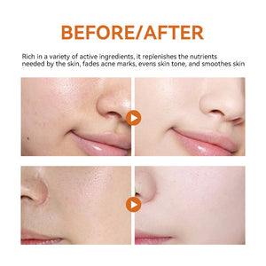 Turmeric Facial Mask Facial Care Hydrating