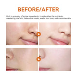 Turmeric Facial Mask Facial Care Hydrating